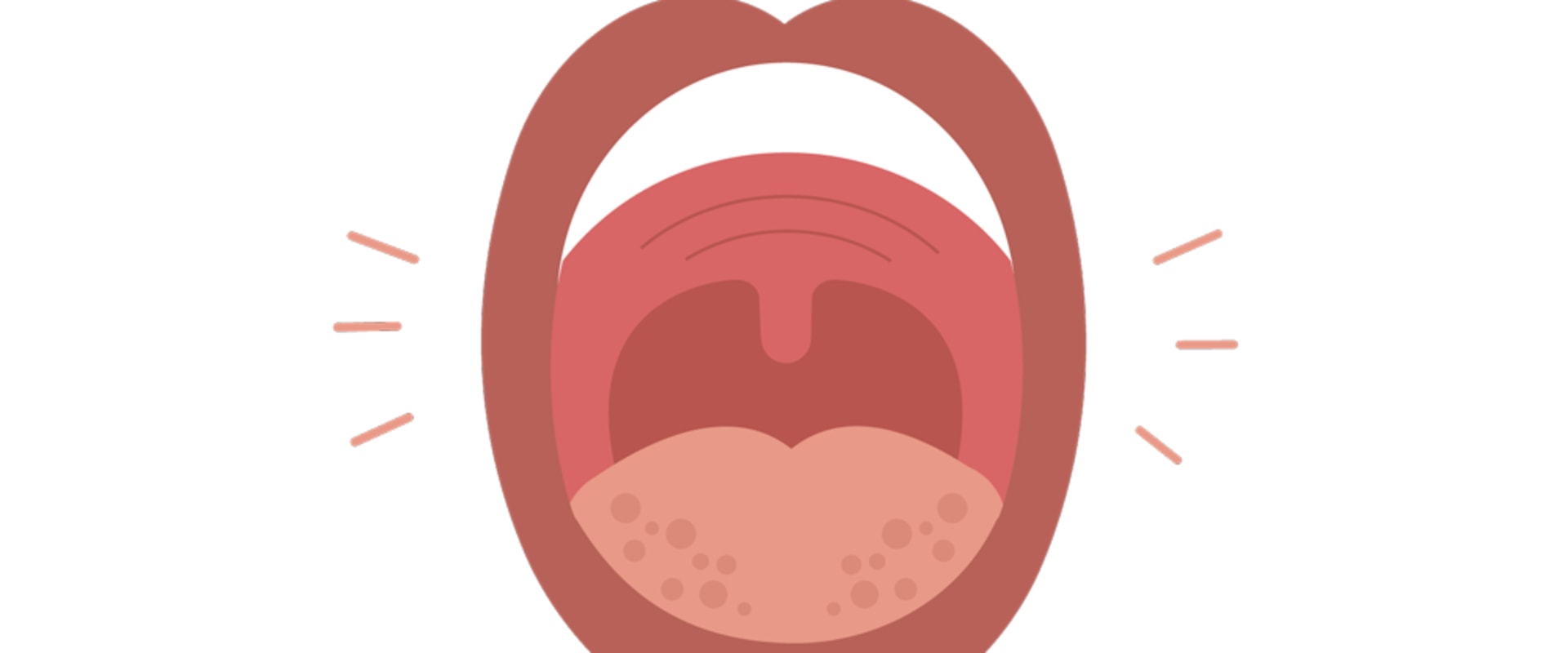 Can Dental Allergies Cause Swelling of the Lips or Tongue?