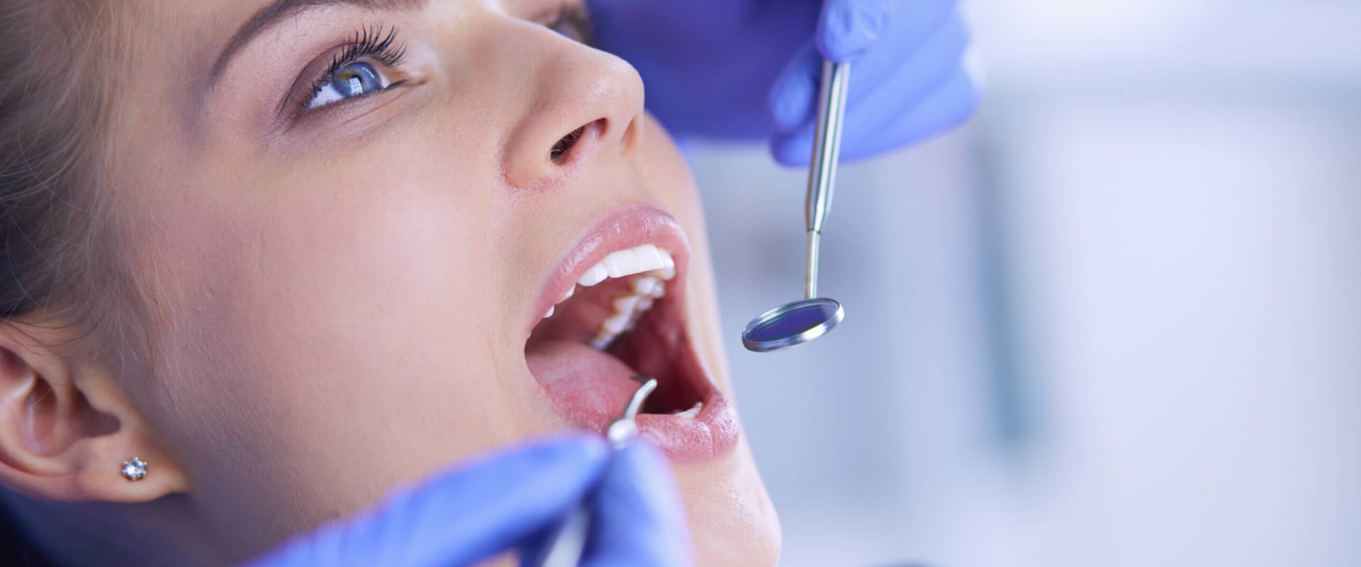 Alternative Therapies for Dental Allergies