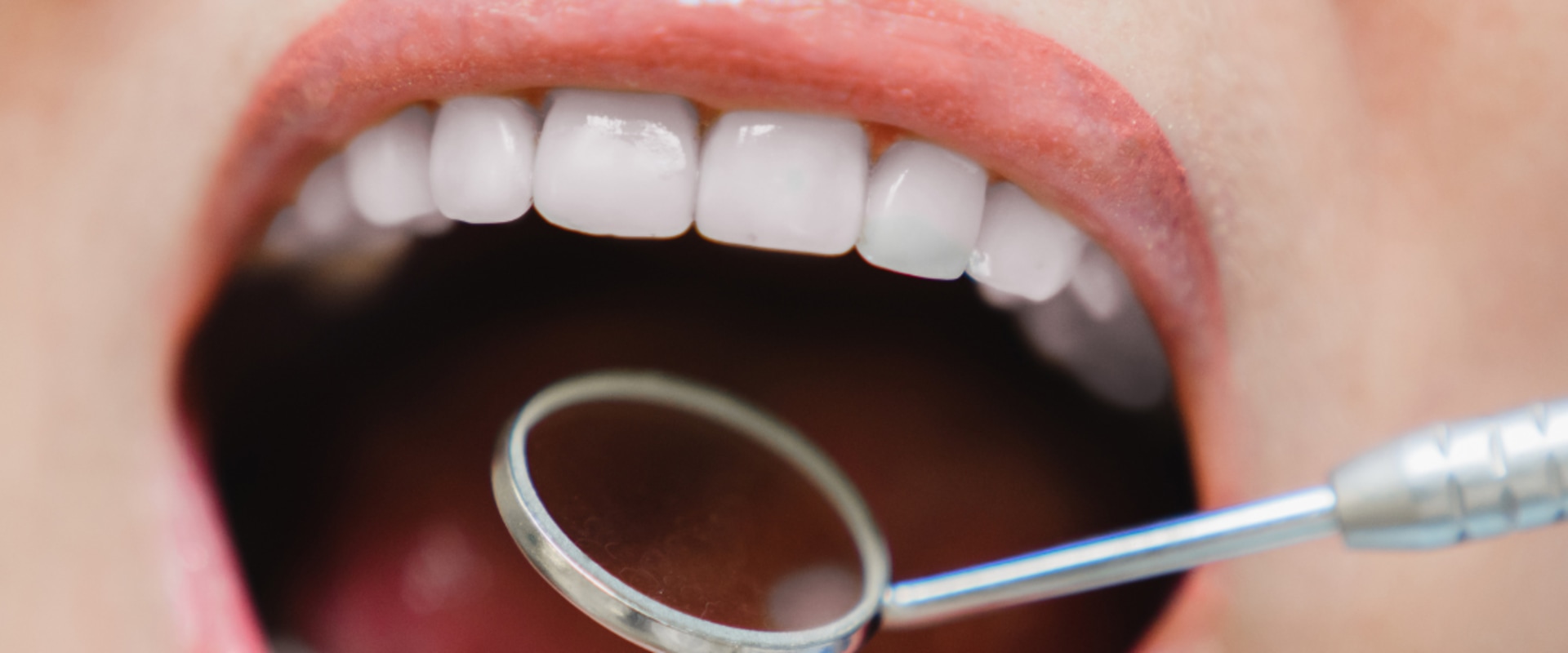 How A Periodontist In Rockville, Maryland Can Help If You Have Dental Allergies?