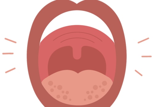 Can Dental Allergies Cause Swelling of the Lips or Tongue?