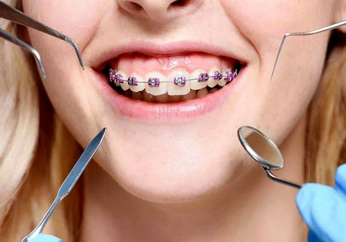 How To Manage Dental Allergies During Invisalign Treatment In Austin