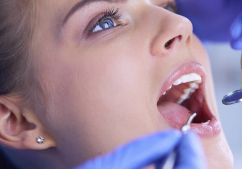 What Type of Dentist Should I See for My Dental Allergies?