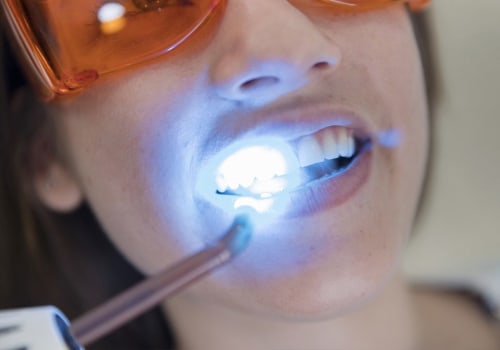 Brighten Your Smile: Tips For Safe Teeth Whitening In Austin For Those With Dental Allergies